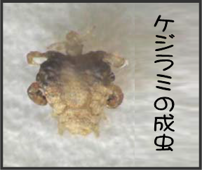 ケジラミ